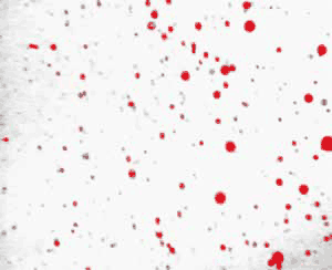 Using the Fill Holes procedure to eliminate open areas in the oil droplets